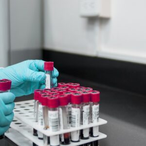 lab, experiment, test, chemistry, test tubes, laboratory, hands, gloves, surgical gloves, blood samples, lab, lab, lab, lab, lab, chemistry, laboratory, laboratory, laboratory, laboratory
