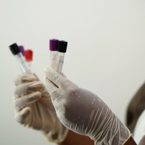 laboratory, test tubes, medical staff, researcher, coronavirus, pandemic, lab test, blood sample, blood specimen, test tubes, medical staff, medical staff, medical staff, medical staff, medical staff, lab test, blood sample, blood sample, blood sample, blood sample, blood sample