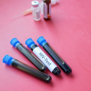 Four HIV test blood samples in vacutainers against a pink background. Medical and laboratory concept.