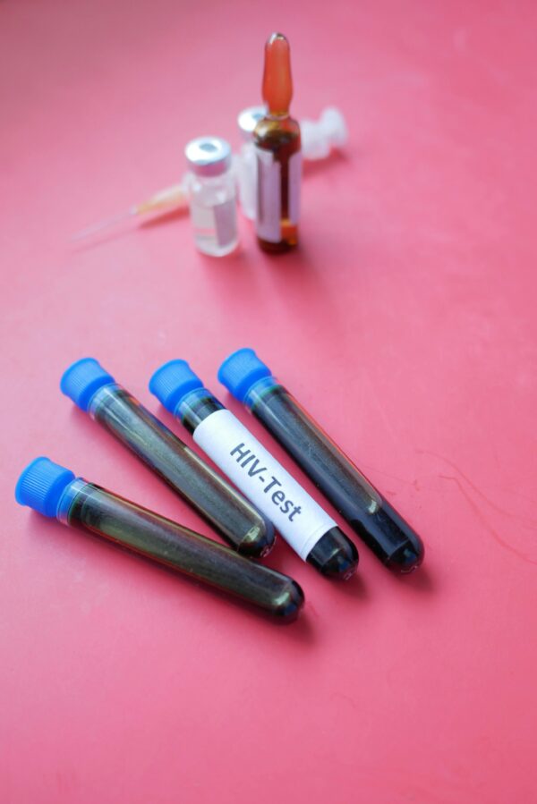 Four HIV test blood samples in vacutainers against a pink background. Medical and laboratory concept.